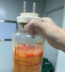 葫芦岛水动力吸脂手术要做多久？